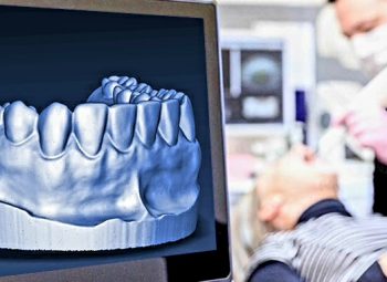 3D Dental Scanning