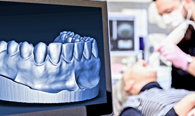 3D Dental Scanning